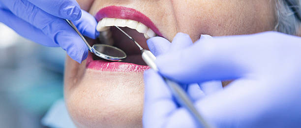 Best Emergency Orthodontic Repairs in Bement, IL